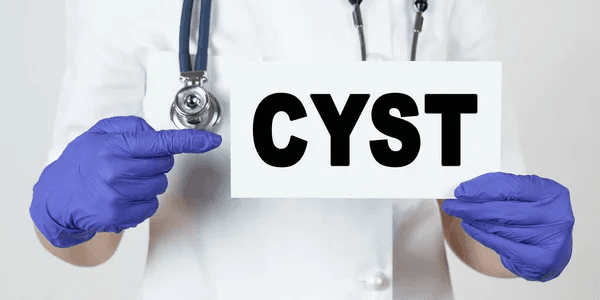 Cyst